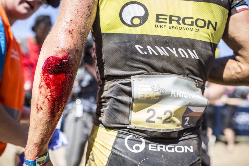 Kristian Hynek fue uno de los grandes damnificados de la 3ª etapa. Una fuerte caída le produjo serios daños físicos. Foto Nick Muzik/Cape Epic/SPORTZPICS 