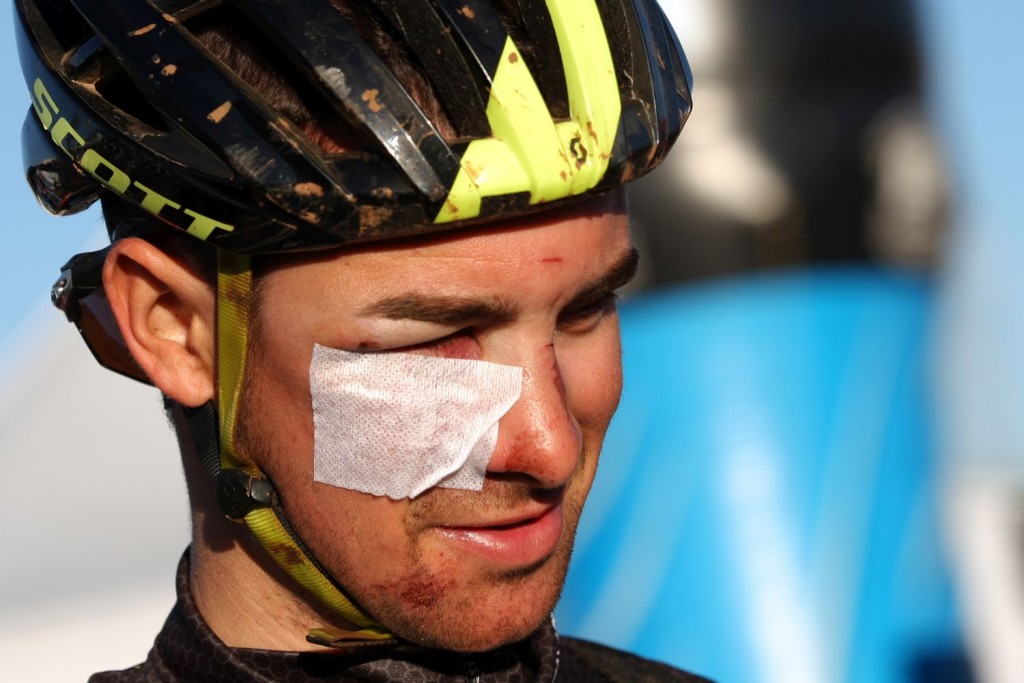 Francesc Girones, biker del Scott-Taymory, sufrió una aparatosa caída que dañó su rostro. Sigue en carrera a pesar de ello.
