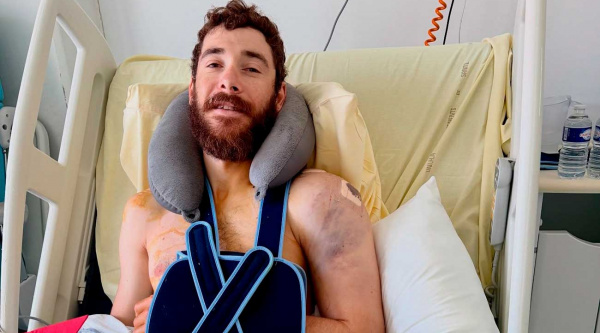 Victor Koretzky sufre una fractura de húmero y se perderá el inicio de la Copa del Mundo